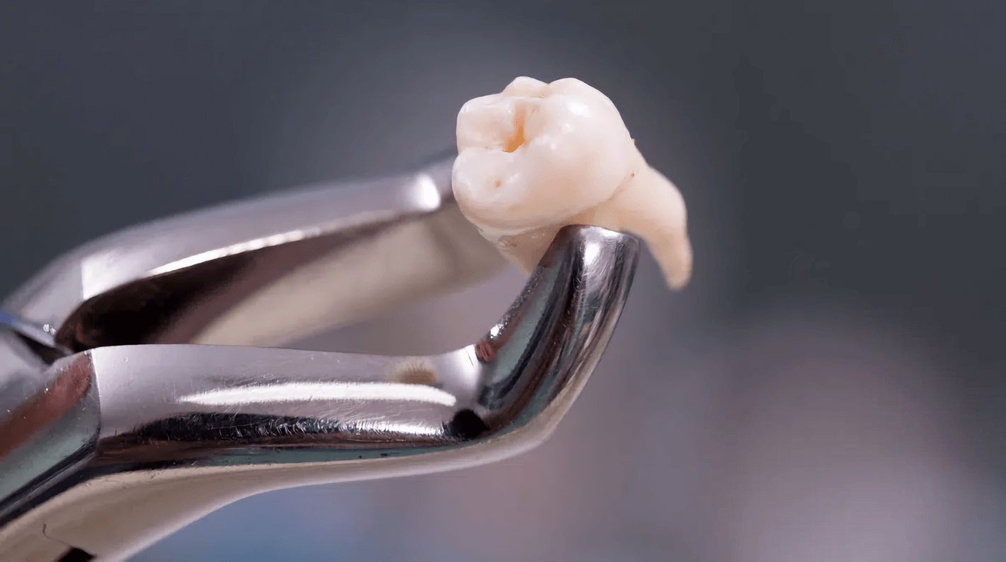 How to choose the forceps to be used on each tooth?